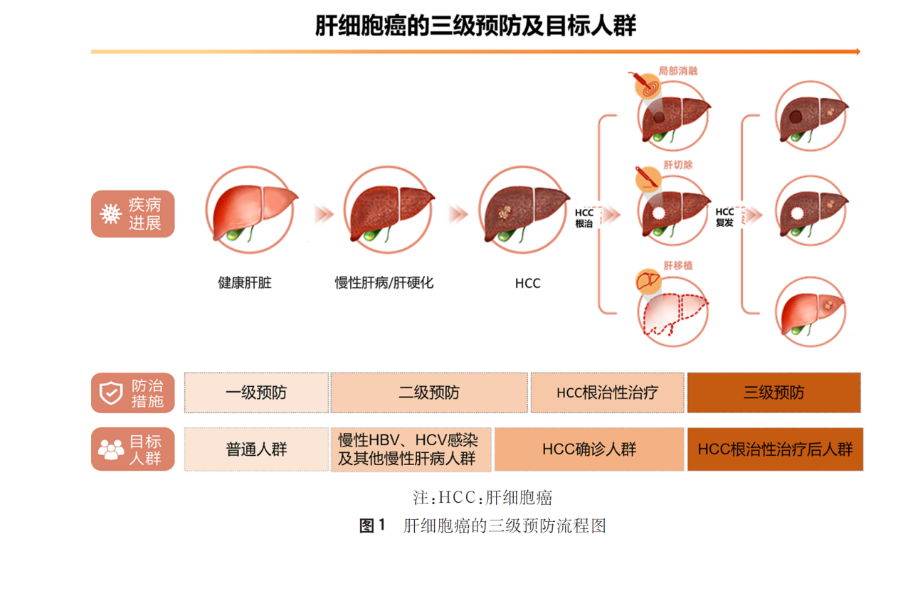 原發(fā)性肝癌三級預(yù)防共識（2022年版）指出復(fù)方鱉甲軟肝片有助于降低肝癌復(fù)發(fā)風(fēng)險
