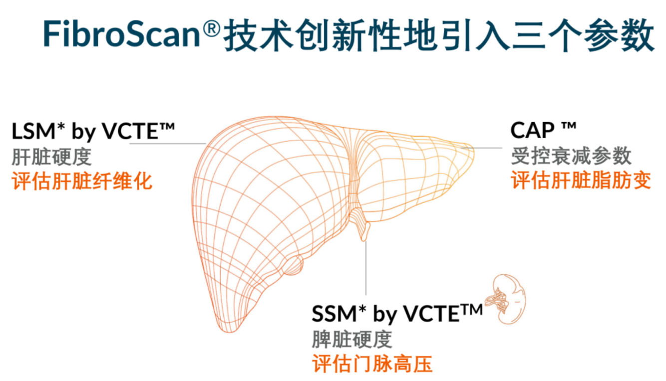 喜訊！FDA擴大了FibroScan?在肝臟綜合管理中的應(yīng)用范圍